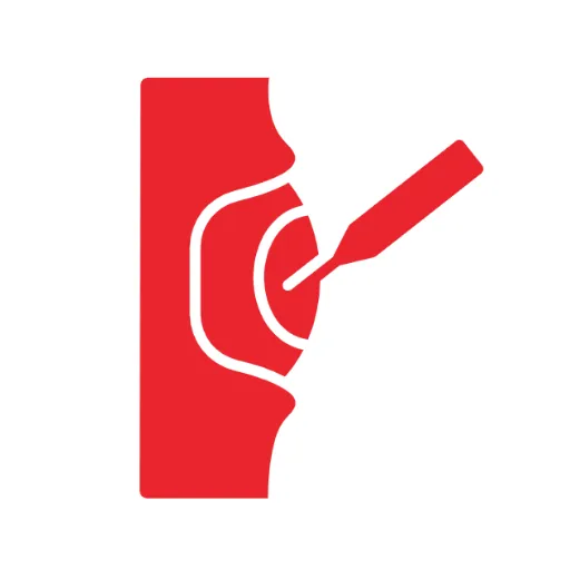 ACL Revision Surgery