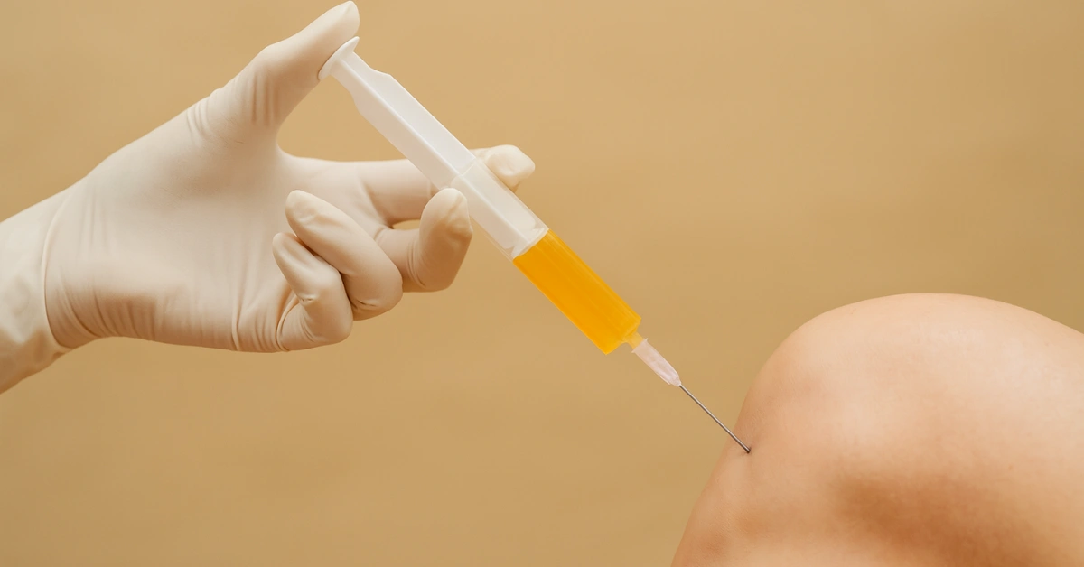 PRP Therapy in Orthopedics