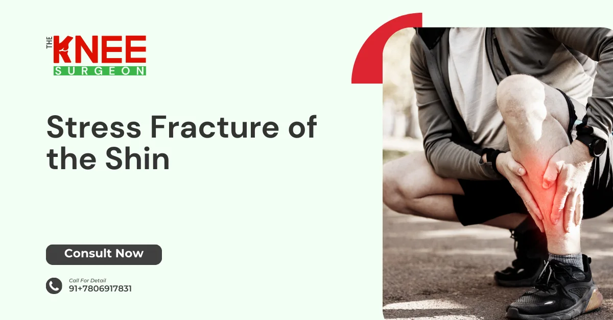 Stress Fracture of the Shin