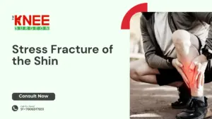 Stress Fracture of the Shin