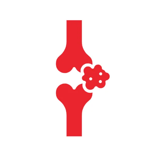 TFCC Repair (Triangular Fibro Cartilage)