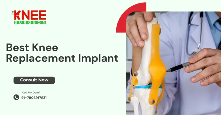 Best Knee Replacement Implant