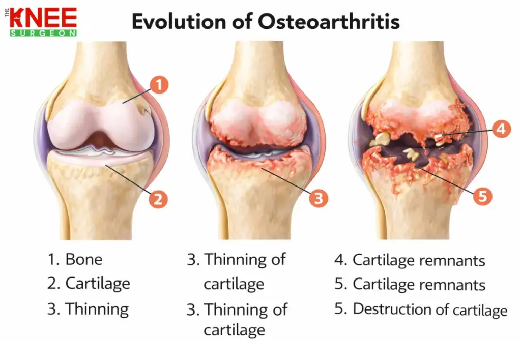 Best Orthopedic Doctor in Kilpauk 2 Best Orthopedic Doctor in Kilpauk