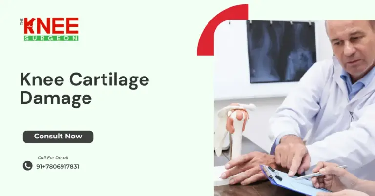 Knee Cartilage Damage