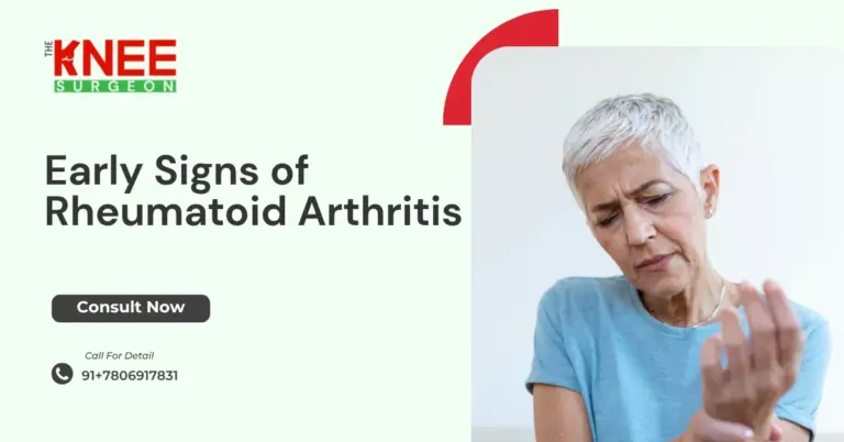 Early Signs of Rheumatoid Arthritis