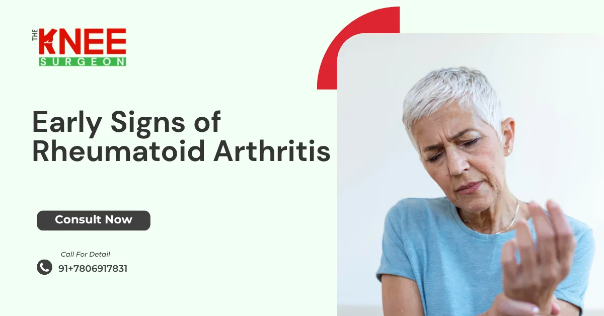 Early Signs of Rheumatoid Arthritis