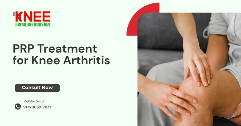 PRP Treatment for Knee Arthritis