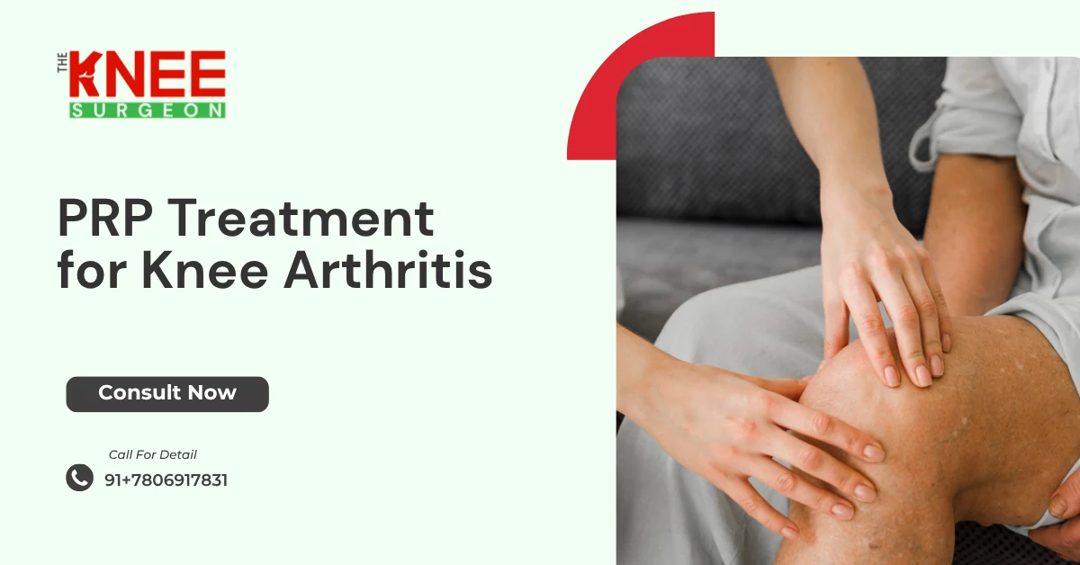 PRP Treatment for Knee Arthritis