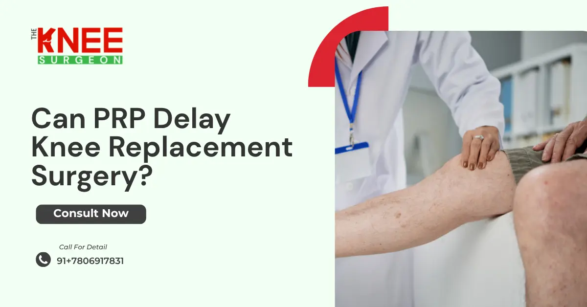 Can PRP Delay Knee Replacement Surgery?