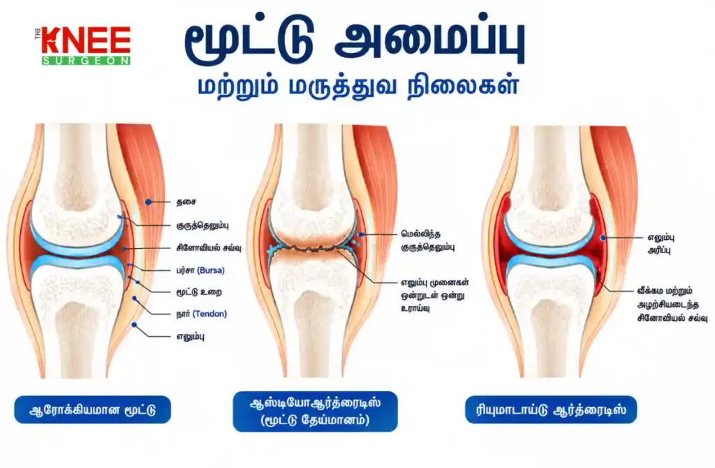 பெண்களுக்கு முழங்கால் வலி ஏற்படுவதற்கான காரணங்கள் என்ன? 1 பெண்களுக்கு முழங்கால் வலி ஏற்படுவதற்கான காரணங்கள் என்ன?